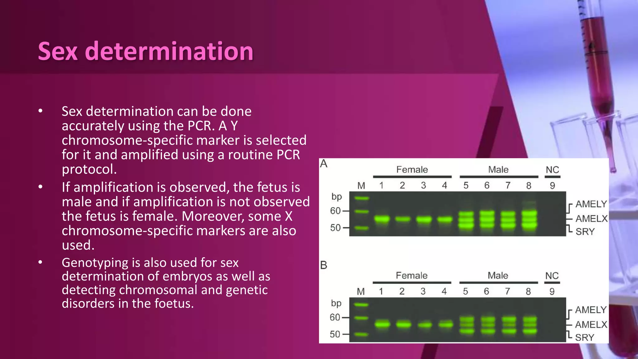 Sex determination
• Sex determination can be done
accurately using the PCR. A Y
chromosome-specific marker is selected
for it and amplified using a routine PCR
protocol.
• If amplification is observed, the fetus is
male and if amplification is not observed
the fetus is female. Moreover, some X
chromosome-specific markers are also
used.
• Genotyping is also used for sex
determination of embryos as well as
detecting chromosomal and genetic
disorders in the foetus.
 
