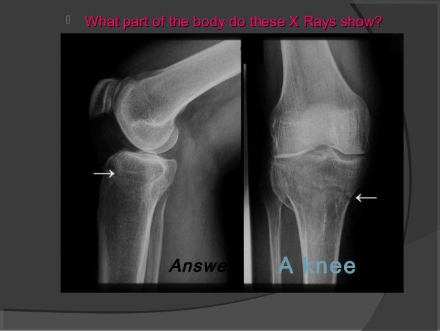 Applications of Physics in Medical industry