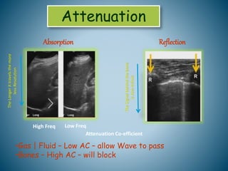 applications-of-ultrasound-in-medicine-pptx