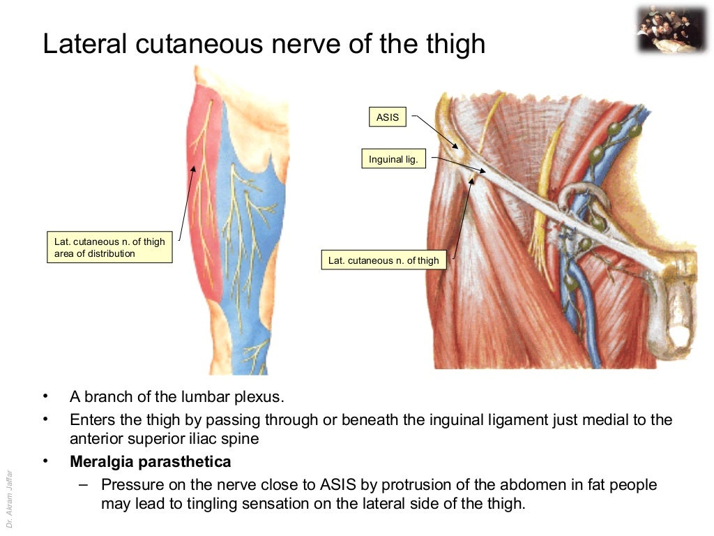 Applied anatomy lateral femoral cutaneous nerve injury
