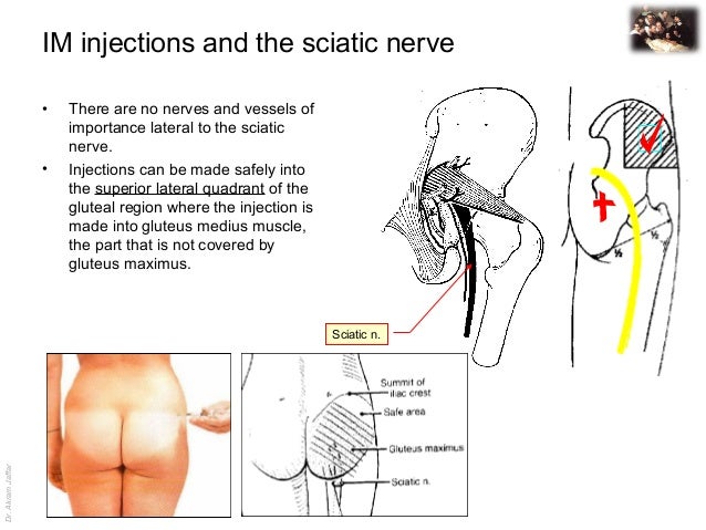 sciatic nerve anatomy
