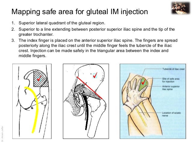 Applied anatomy sciatic nerve injury