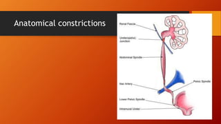 Anatomical constrictions
 