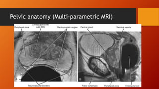 Pelvic anatomy (Multi-parametric MRI)
 