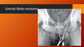Genital Radio-Anatomy
 
