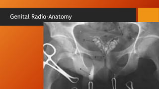 Genital Radio-Anatomy
 