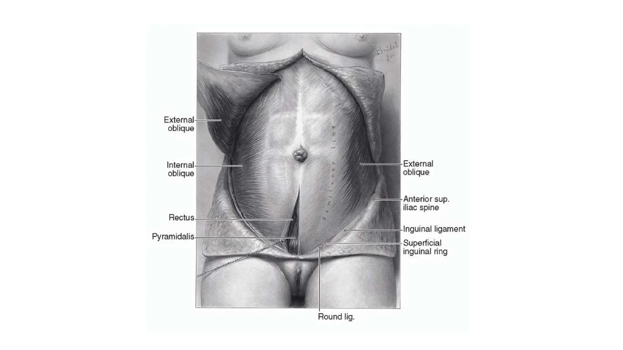 Applied anatomy of anterior abdominal wall.pptx
