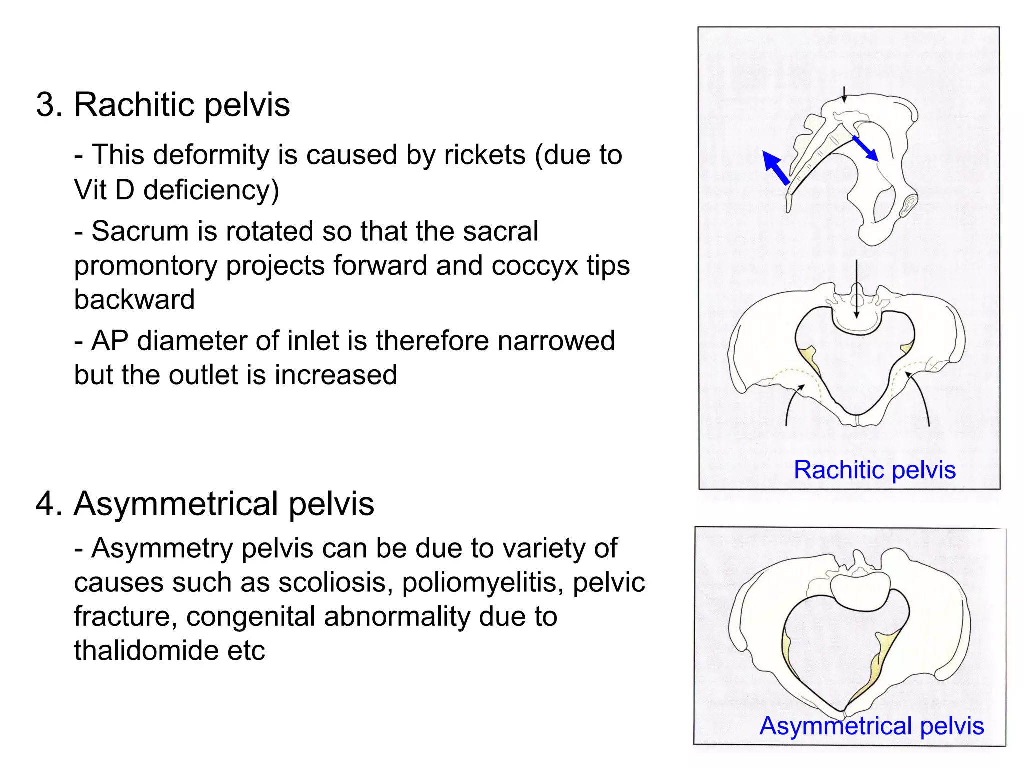 Applied anatomy of pelvis and fetal skull | PPT