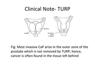 Applied anatomy of the prostate and seminal vesicles | PPTX