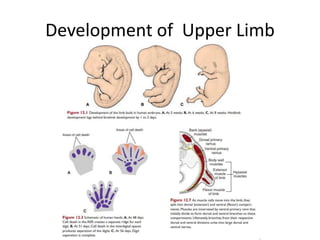 Development of Upper Limb
 