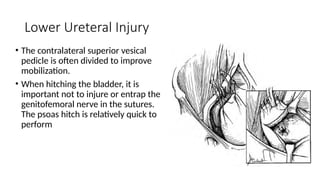 Applied Anatomy of Ureter in detail for urologist | PPTX