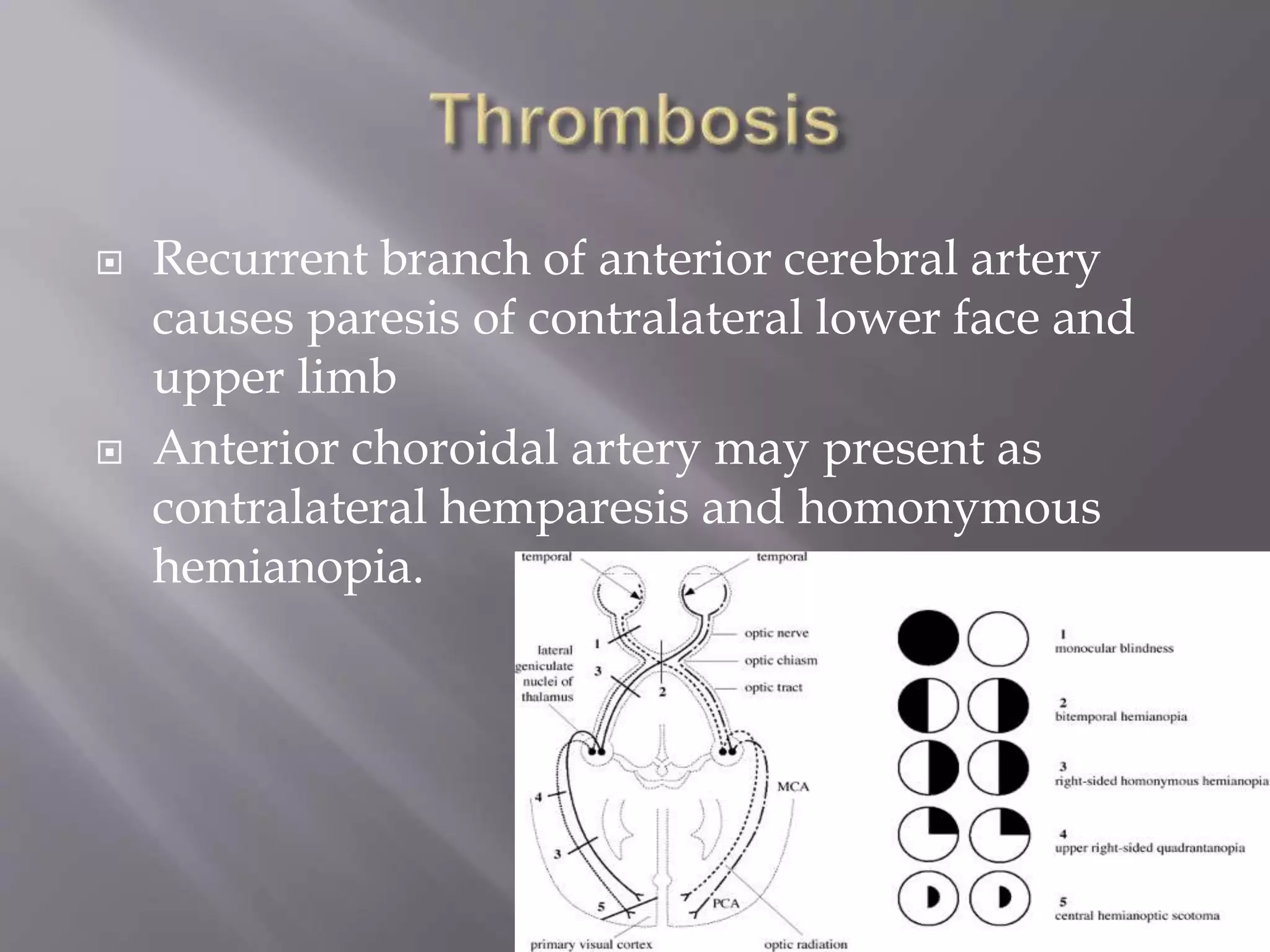  Recurrent branch of anterior cerebral artery
causes paresis of contralateral lower face and
upper limb
 Anterior choroidal artery may present as
contralateral hemparesis and homonymous
hemianopia.
 