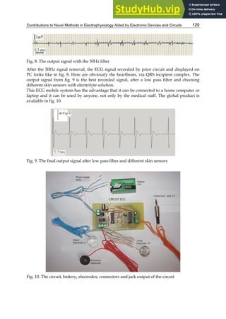 Contributions to Novel Methods in Electrophysiology Aided by Electronic Devices and Circuits 129
Fig. 8. The output signal with the 50Hz filter
After the 50Hz signal removal, the ECG signal recorded by prior circuit and displayed on
PC looks like in fig. 8. Here are obviously the heartbeats, via QRS incipient complex. The
output signal from fig. 9 is the best recorded signal, after a low pass filter and choosing
different skin sensors with electrolyte solution.
This ECG mobile system has the advantage that it can be connected to a home computer or
laptop and it can be used by anyone, not only by the medical staff. The global product is
available in fig. 10.
Fig. 9. The final output signal after low pass filter and different skin sensors
Fig. 10. The circuit, battery, electrodes, connectors and jack output of the circuit
 
