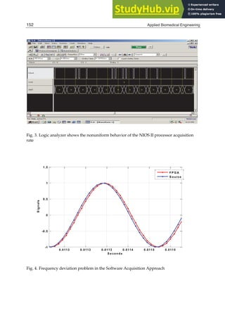 12 Will-be-set-by-IN-TECH
Fig. 3. Logic analyzer shows the nonuniform behavior of the NIOS II processor acquisition
rate
0.0113 0.0113 0.0113 0.0114 0.0115 0.0115
-1
-0.5
0
0.5
1
1.5
S e conds
S
i
g
n
a
l
s
FP G A
S ource
Fig. 4. Frequency deviation problem in the Software Acquisition Approach
152 Applied Biomedical Engineering
 
