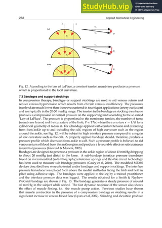 16 Will-be-set-by-IN-TECH
Fig. 12. According to the law of LaPlace, a constant tension membrane produces a pressure
which is proportional to the local curvature.
7.3 Bandages and support stockings
In compression therapy, bandages or support stockings are used to aid venous return and
reduce venous hypertension which results from chronic venous insufﬁciency. The pressures
involved are much lower than those encountered in tourniquet applications (artery occlusion)
and are typically in the 20-50 mmHg range. The tension in the bandage or stocking membrane
produces a compression or normal pressure on the supporting limb according to the so called
’Law of LaPlace’. The pressure is proportional to the membrane tension, the number of turns
(membrane layers) and the curvature of the limb, P ∝ TNκ where the curvature κ = 1/R for a
cylindrical geometry of radius R. For a bandage applied with constant tension and extending
from foot/ankle up to and including the calf, regions of high curvature such as the region
around the ankle, see Fig. 12, will be subject to high interface pressure compared to a region
of low curvature such as the calf. A properly applied bandage should, therefore, produce a
pressure proﬁle which decreases from ankle to calf. Such a pressure proﬁle is believed to aid
venous return of blood from the ankle region and produce a favourable effect on subcutaneous
interstitial pressures (Giswold  Moneta, 2005)
Bandages are designed to generate a pressure in the ankle region of about 40 mmHg dropping
to about 20 mmHg just distal to the knee. A sub-bandage interface pressure transducer
based on micromoulded (soft-lithography) elastomer springs and ﬂexible circuit technology
has been used to measure sub-bandage pressures (Casey et al, 2010). The modiﬁed MEMS
devices described here were also tested under bandages and support stockings. The interface
pressure transducer was placed 5 cm above the medial malleolus facing the limb and held in
place using adhesive tape. The bandages were applied to the leg by a trained practitioner
and the interface pressure data was logged. The results obtained for a Smith  Nephew
ProGuide bandage are shown in Fig. 13. The bandage generates a steady pressure of around
40 mmHg in the subject while seated. The fast dynamic response of the sensor also shows
the effect of muscle ﬂexing, i.e. the muscle pump action. Previous studies have shown
that muscle contraction in the presence of a compression bandage or stocking results in a
signiﬁcant increase in venous blood ﬂow (Lyons et al, 2002). Standing and elevation produce
258 Applied Biomedical Engineering
 