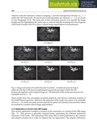 APPLIED BIOMEDICAL ENGINEERING.pdf