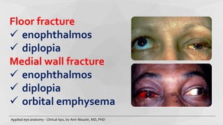 Applied eye anatomy...clinical tips | PPTX