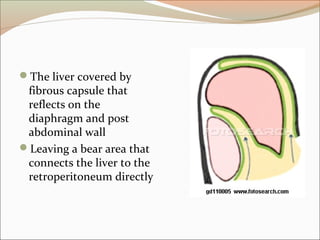The liver covered by
fibrous capsule that
reflects on the
diaphragm and post
abdominal wall
Leaving a bear area that
connects the liver to the
retroperitoneum directly
 