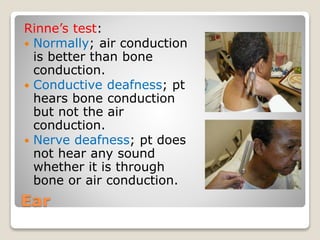 Ear
Rinne’s test:
 Normally; air conduction
is better than bone
conduction.
 Conductive deafness; pt
hears bone conduction
but not the air
conduction.
 Nerve deafness; pt does
not hear any sound
whether it is through
bone or air conduction.
 