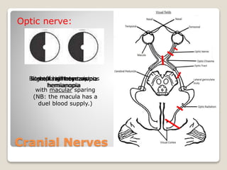 Cranial Nerves
Optic nerve:
Right nasal hemianopiaLoss of right eye visionBitemporal heteronymus
hemianopia
Left homonymus
hemianopia
with macular sparing
(NB: the macula has a
duel blood supply.)
 