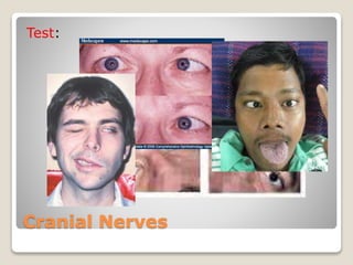 Cranial Nerves
Test:
 