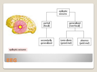 EEG
 