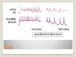 EEG
 