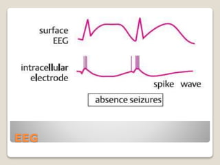 EEG
 