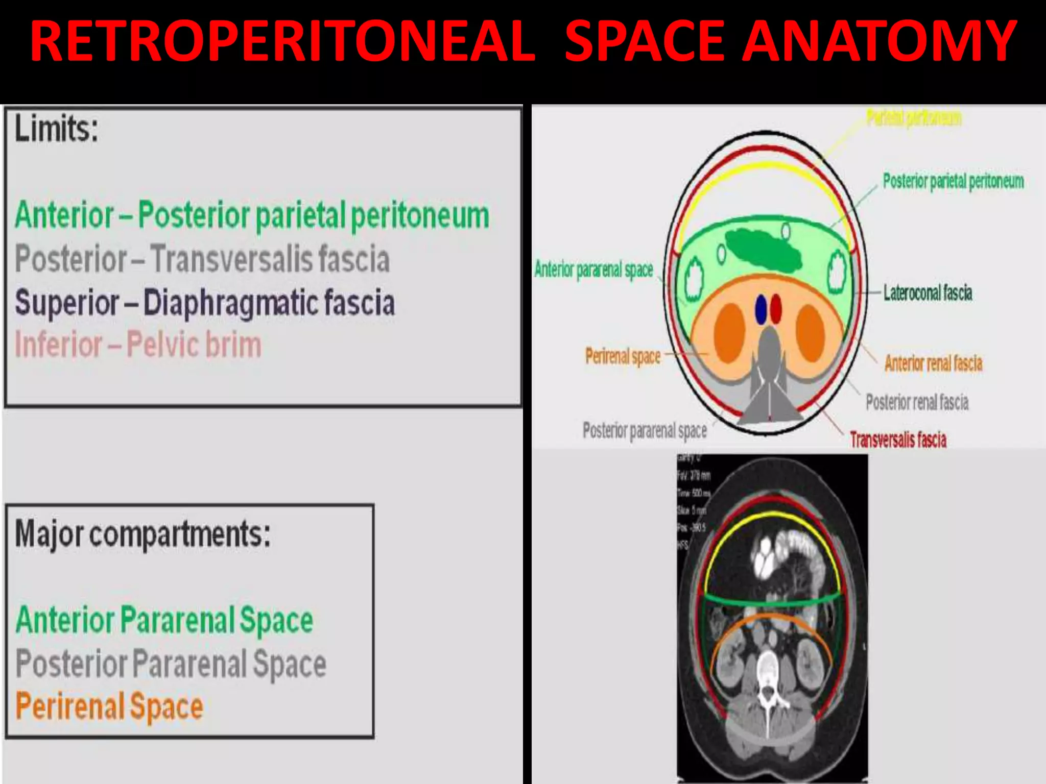 RETROPERITONEAL SPACE ANATOMY
 