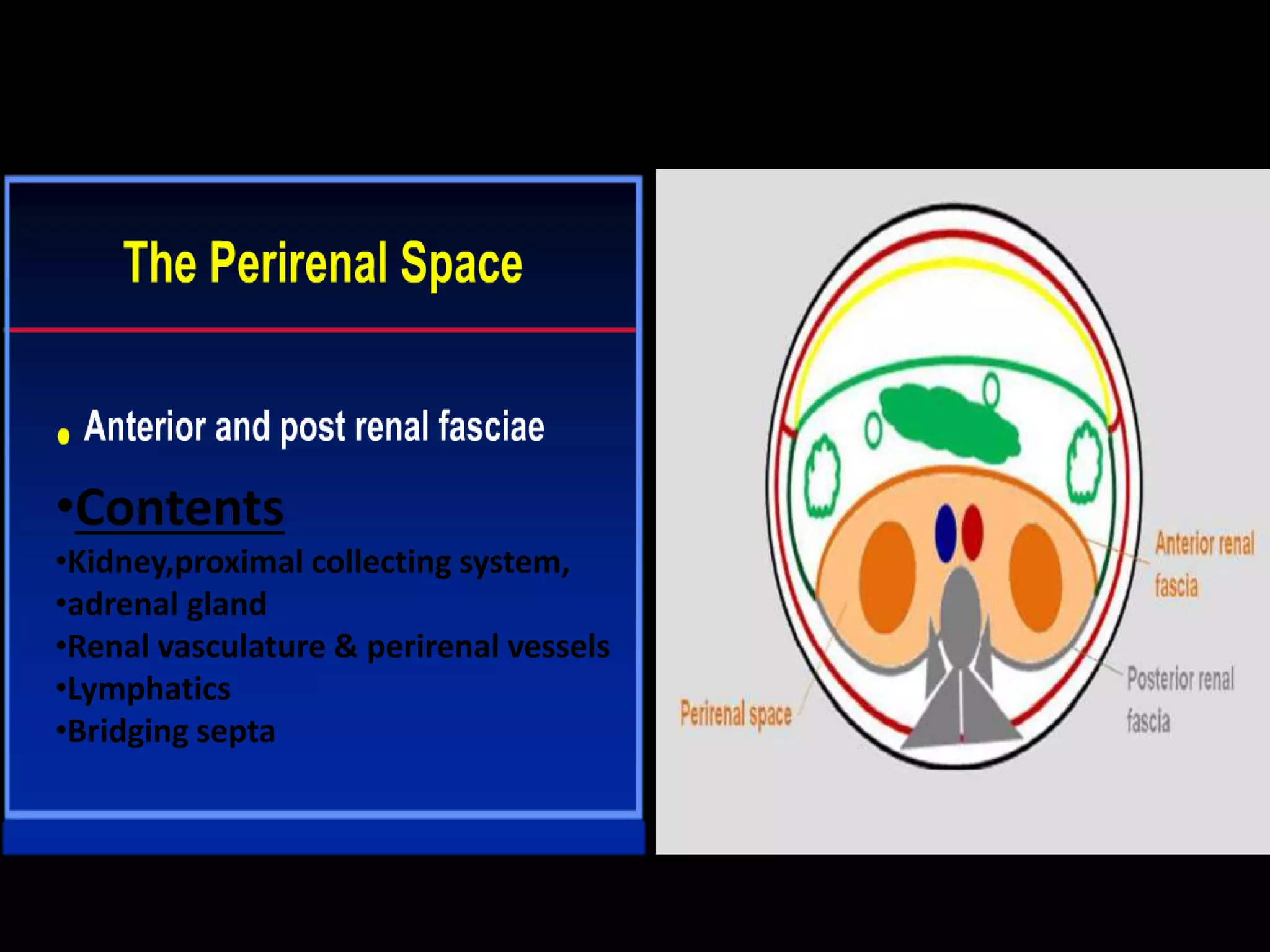 •Contents
•Kidney,proximal collecting system,
•adrenal gland
•Renal vasculature & perirenal vessels
•Lymphatics
•Bridging septa
 