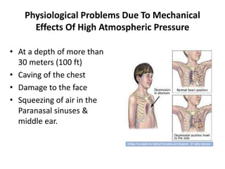 Physiological Problems Due To Mechanical
Effects Of High Atmospheric Pressure
• At a depth of more than
30 meters (100 ft)
• Caving of the chest
• Damage to the face
• Squeezing of air in the
Paranasal sinuses &
middle ear.
 