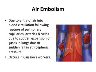 Air Embolism
• Due to entry of air into
blood circulation following
rupture of pulmonary
capillaries, arteries & veins
due to sudden expansion of
gases in lungs due to
sudden fall in atmospheric
pressure.
• Occurs in Caisson’s workers.
 