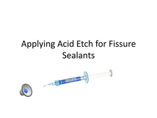 Applying Acid Etch for Fissure
          Sealants
 