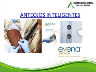 ANTEOJOS INTELIGENTES
 