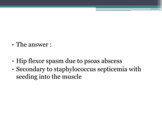 • The answer :
• Hip flexor spasm due to psoas abscess
• Secondary to staphylococcus septicemia with
seeding into the muscle
 