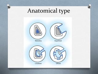 Anatomical type
 