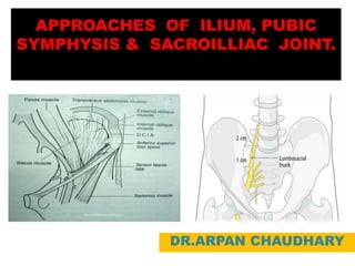 APPROACHES OF ILIUM, PUBIC
SYMPHYSIS & SACROILLIAC JOINT.
DR.ARPAN CHAUDHARY
 