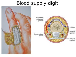 Racket Incision Digits Hand incision Approaches ortho plastic.ppt