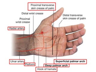 Hand incision Approaches ortho plastic.ppt
