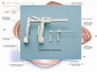 Finochietto retractors
 