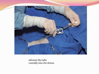advance the tube
cranially into the thorax
 