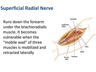 Superficial Radial Nerve
Runs down the forearm
under the brachioradialis
muscle. It becomes
vulnerable when the
“mobile wad” of three
muscles is mobilized and
retracted laterally
 