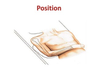 Position
 