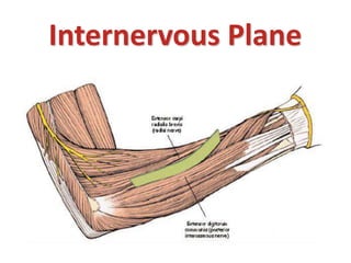 Internervous Plane
 