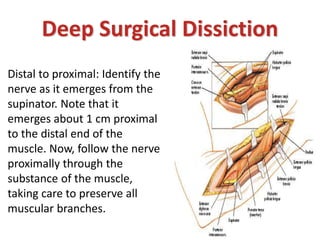 Deep Surgical Dissiction
Distal to proximal: Identify the
nerve as it emerges from the
supinator. Note that it
emerges about 1 cm proximal
to the distal end of the
muscle. Now, follow the nerve
proximally through the
substance of the muscle,
taking care to preserve all
muscular branches.
 