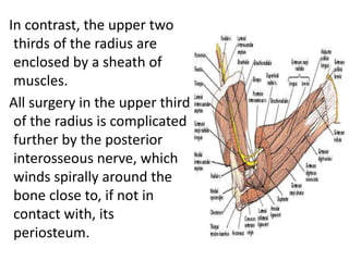 In contrast, the upper two
thirds of the radius are
enclosed by a sheath of
muscles.
All surgery in the upper third
of the radius is complicated
further by the posterior
interosseous nerve, which
winds spirally around the
bone close to, if not in
contact with, its
periosteum.
 