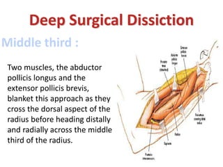 Middle third :
Deep Surgical Dissiction
Two muscles, the abductor
pollicis longus and the
extensor pollicis brevis,
blanket this approach as they
cross the dorsal aspect of the
radius before heading distally
and radially across the middle
third of the radius.
 