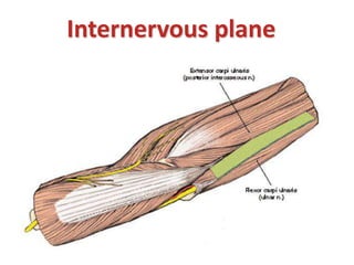 Internervous plane
 