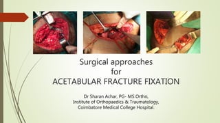 Surgical approaches
for
ACETABULAR FRACTURE FIXATION
Dr Sharan Achar, PG- MS Ortho,
Institute of Orthopaedics & Traumatology,
Coimbatore Medical College Hospital.
 