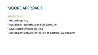 Moore Approach Approaches to hip joint | PPTX